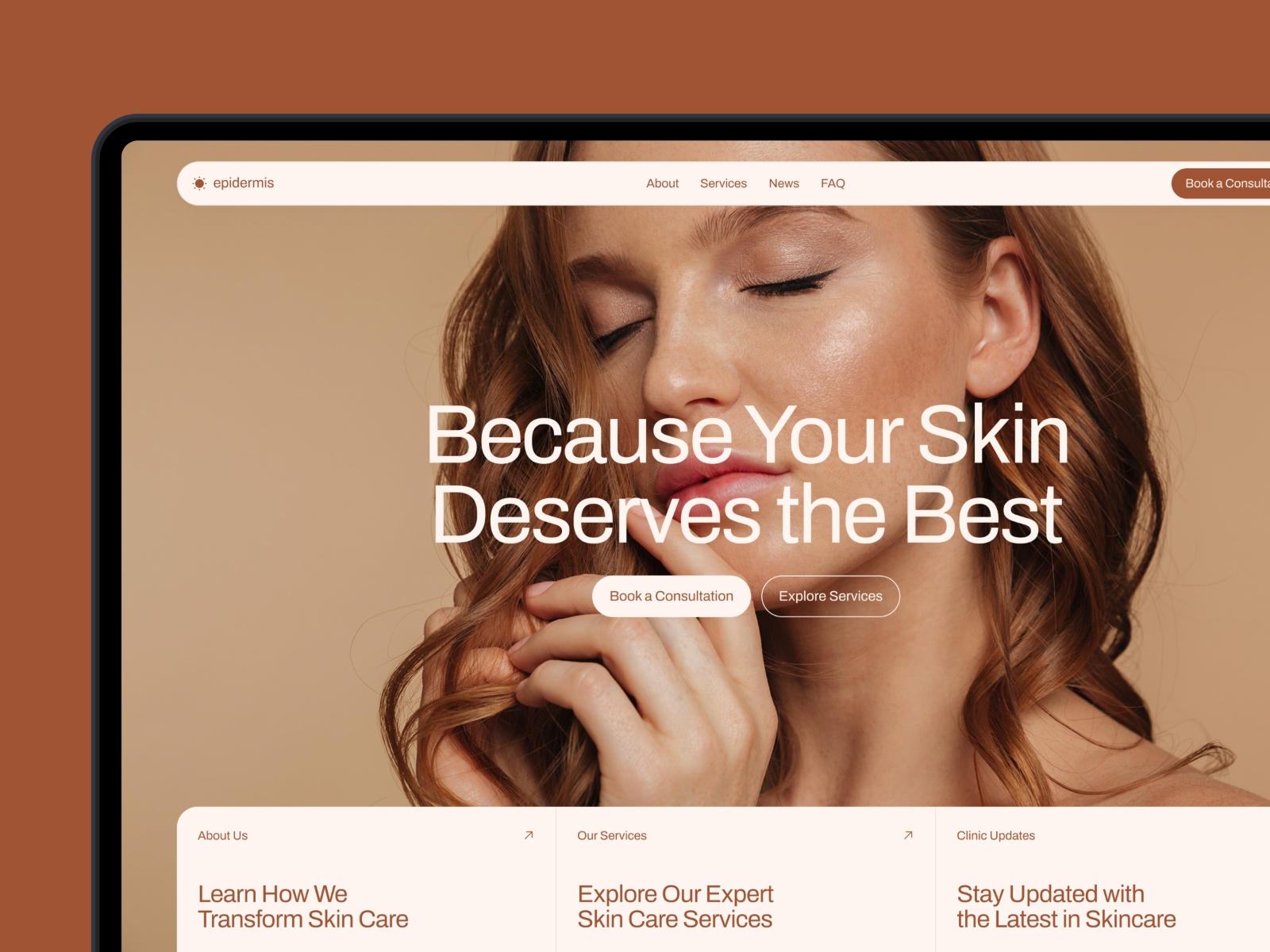 Epidermis